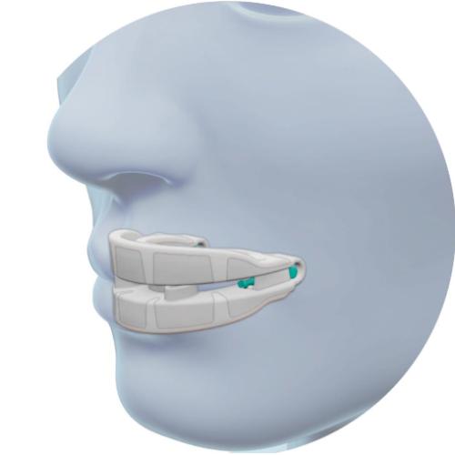 Snore-Reducing-Mouthpiece